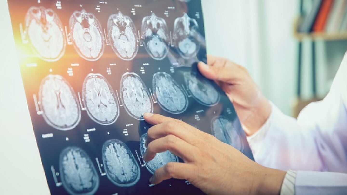 Terazosin shows top line results in ALS treatment.