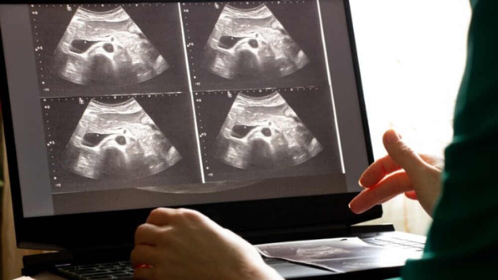 Pictured: Doctor looking at abdominal ultrasound i