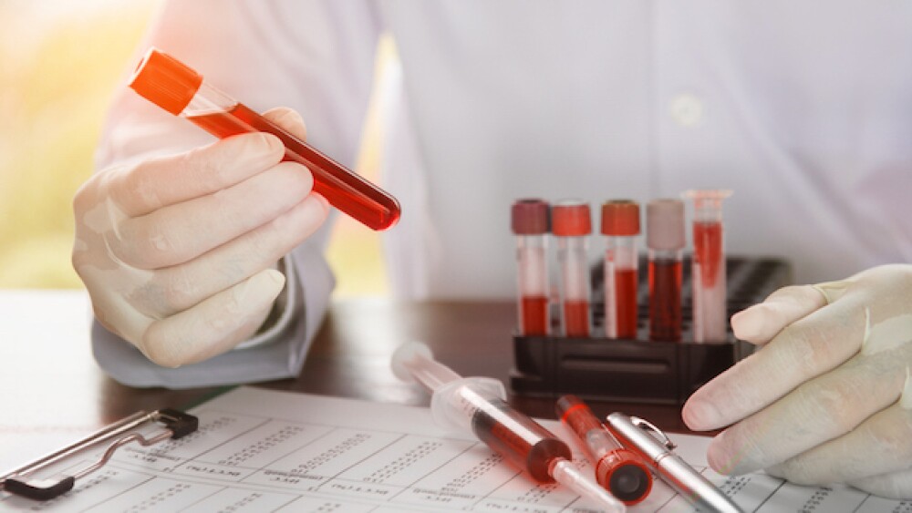 Pictured: Scientist holds vial of blood/BlindTurtl