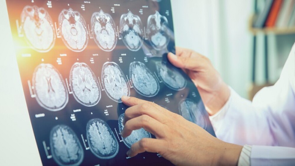 Terazosin shows top line results in ALS treatment.