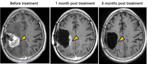 A close-up of a brain scan
AI-generated content may be incorrect.